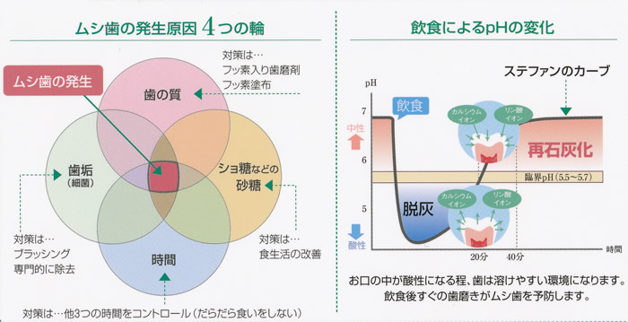 むし歯の発生原因４つの輪と飲食によるｐHの変化