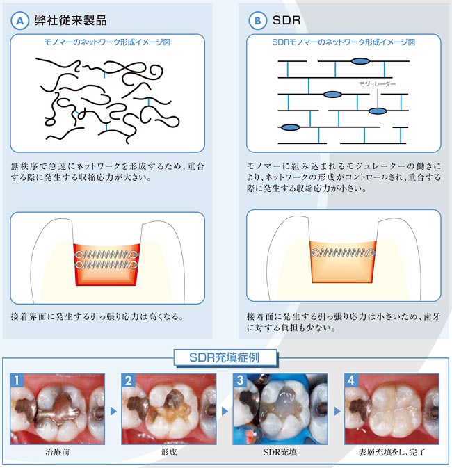 SDR　エスディーアール