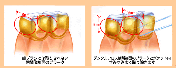 G1אږ