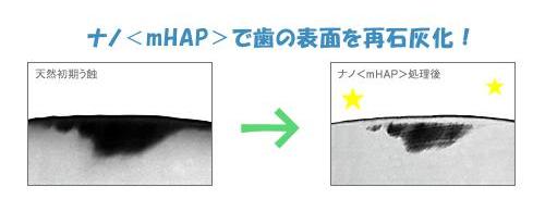 再石灰化