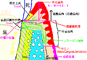 健康な歯肉との付着状態 